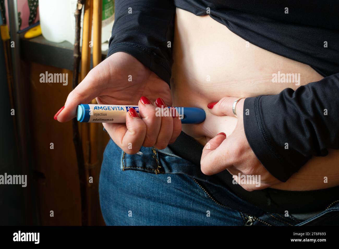 Self injection of adalimumab into abdomen. Amgevita bio similar brand to Humira. Stock Photo