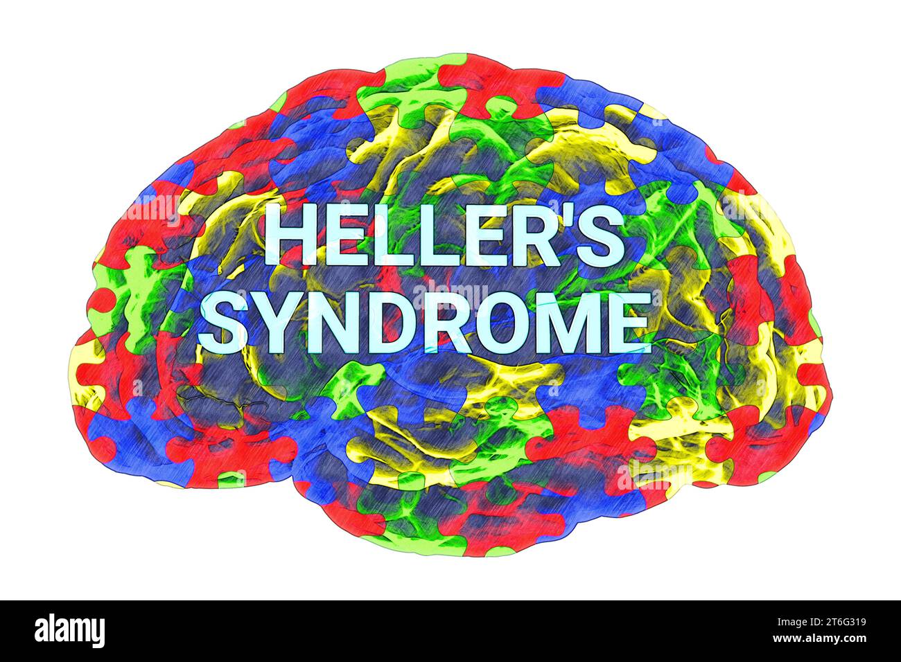 Text Heller's syndrome inside the model of a human brain, with a colorful puzzle pattern on its surface, emphasizing the neurological basis and the di Stock Photo