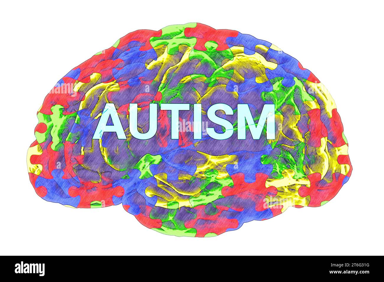 Text Autism inside the anatomical model of a human brain, with a colorful puzzle pattern on its surface, emphasizing the neurological basis and the di Stock Photo