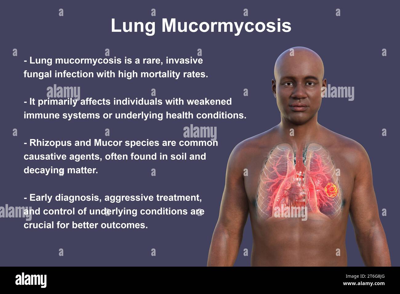 A 3D photorealistic illustration of the upper half part of an African man with transparent skin, revealing a lung mucormycosis lesion Stock Photo