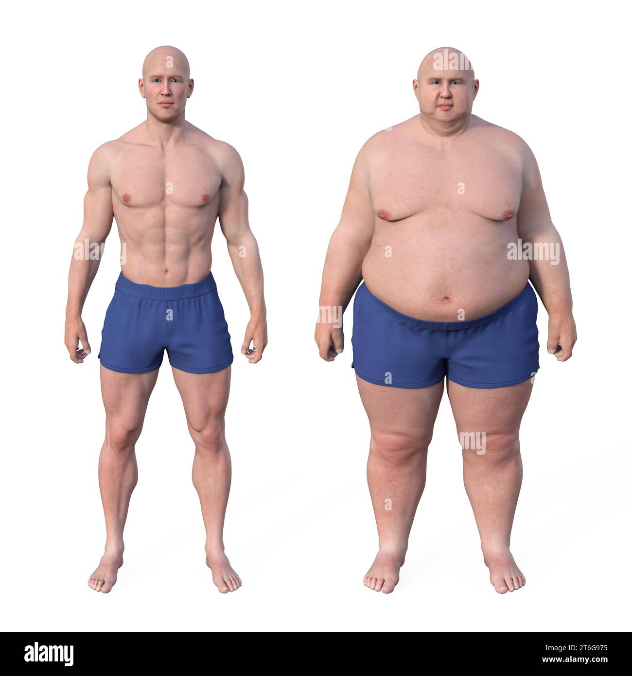 A Comparative 3D Medical Illustration Depicting A Normal Weight Man And a-comparative-3d-medical-illustration-depicting-a-normal-weight-man-and