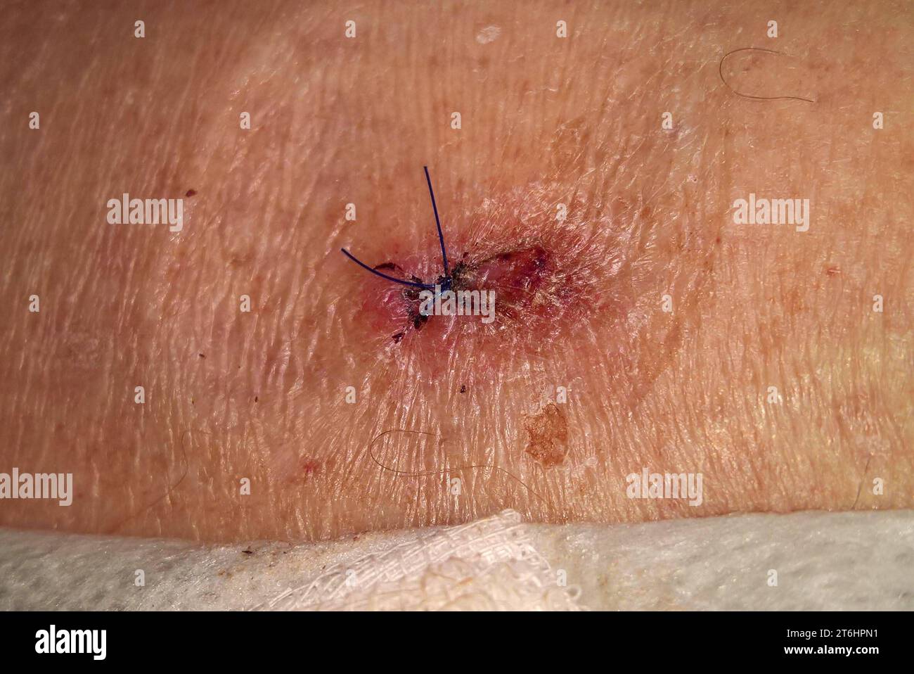 Dermatologie hi-res stock photography and images - Alamy