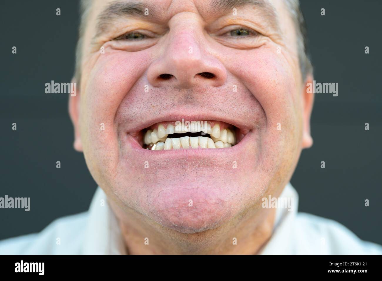 Extreme close up of a man's smile without his Dental prosthesis in front of a black background Stock Photo