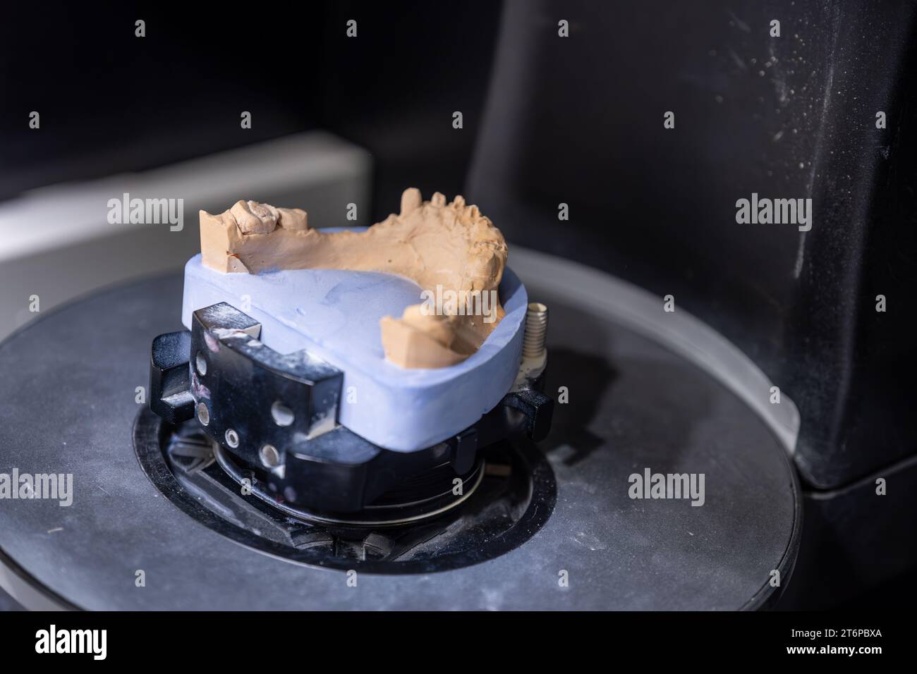 Dental 3D scanner. Dental scan with prosthesis. Create three