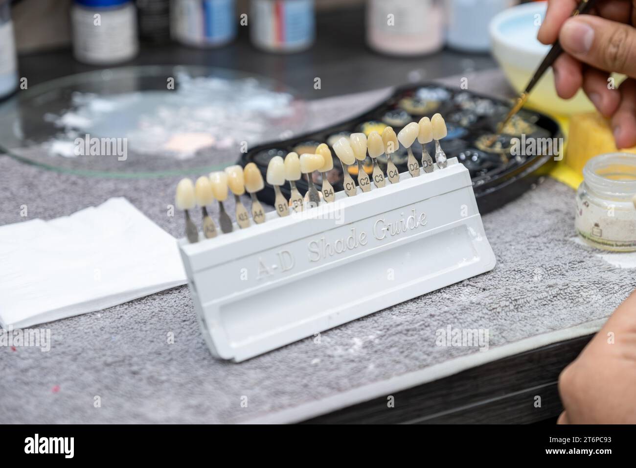 male checking AD shade guide for tooth crowns to select the proper