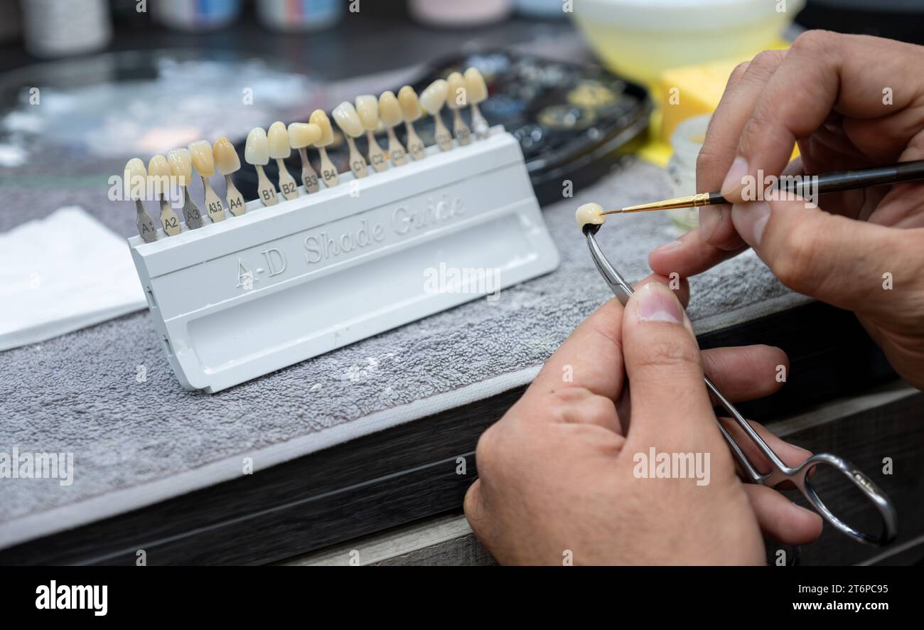 male checking AD shade guide for tooth crowns to select the proper