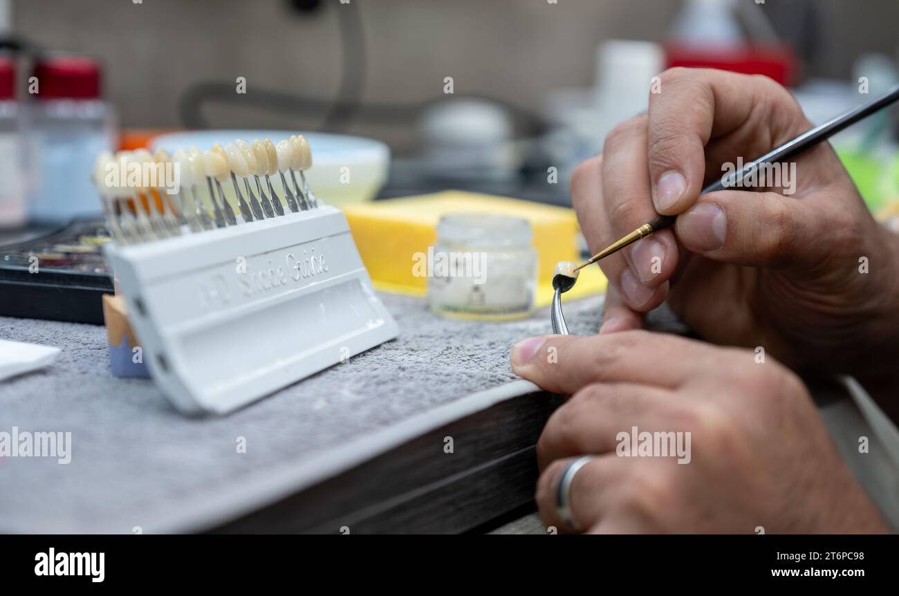 male checking AD shade guide for tooth crowns to select the proper