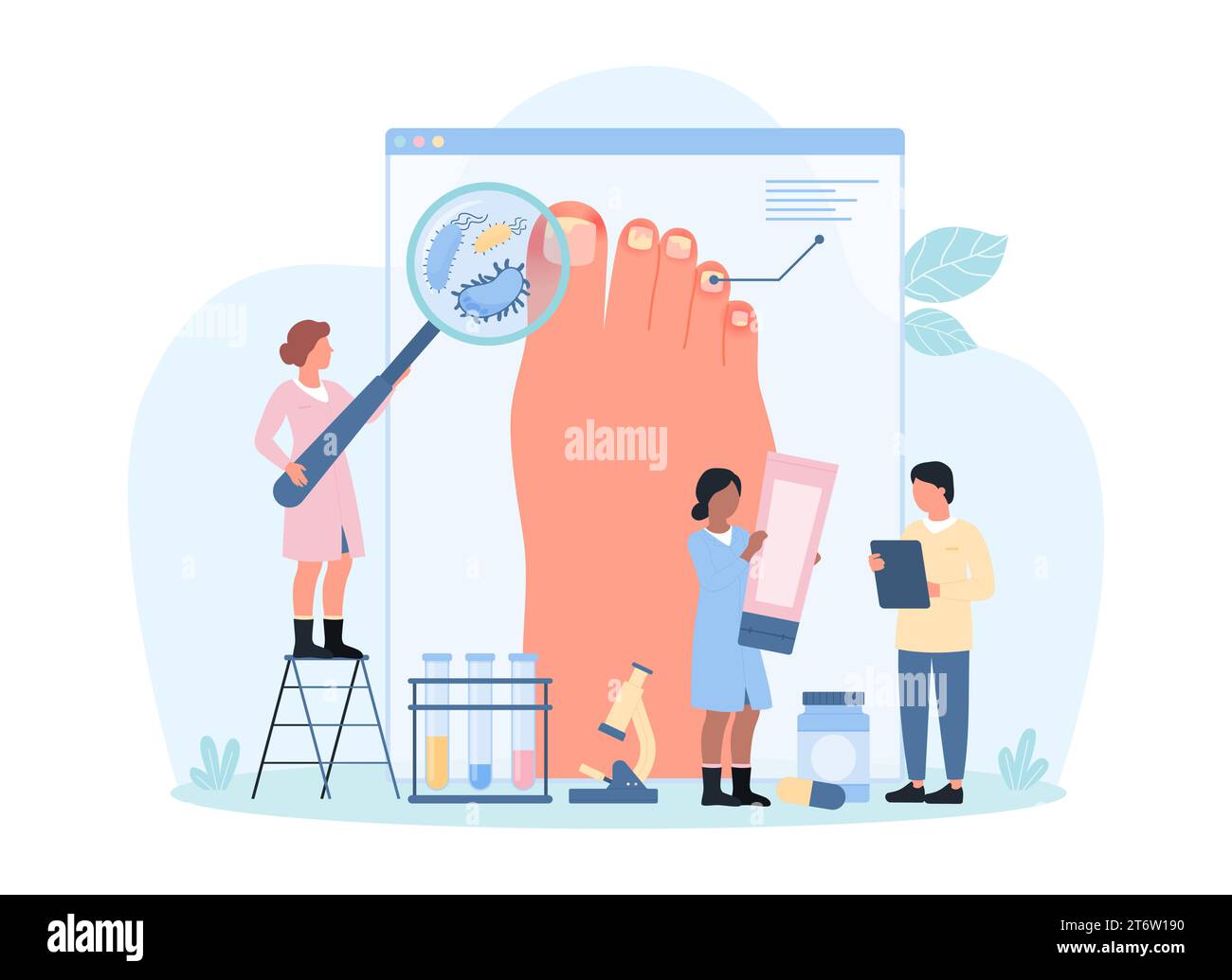 Diagnosis and treatment of fungal infection and nail disease, onychomycosis vector illustration. Cartoon tiny doctors with magnifying glass diagnose microbes on feets skin, advise antifungal treatment Stock Vector