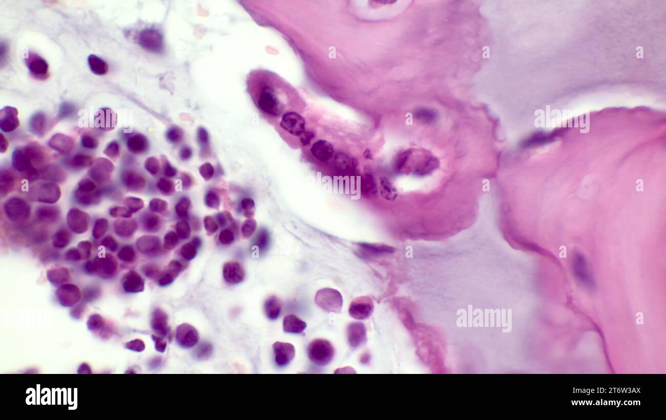 Osteoclast. Light micrograph of an osteoclast displaying typical distinguishing characteristics: a large cell with multiple nuclei. Stock Photo