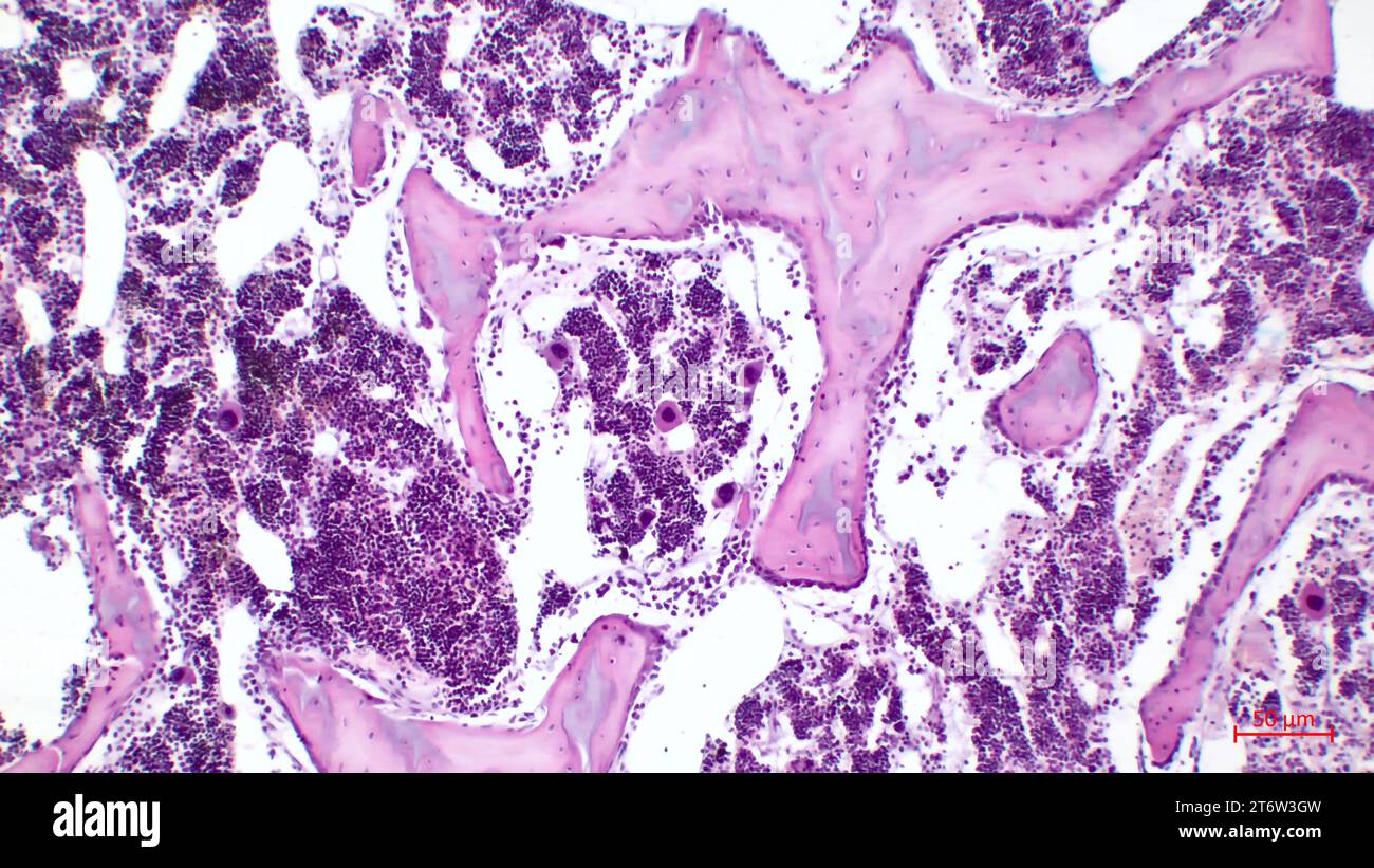 Human red bone marrow, hematopoietic press. The big tsit beetveen erythrocytes are megakaryocytes. Hematoxylin and eosin stain. Stock Photo