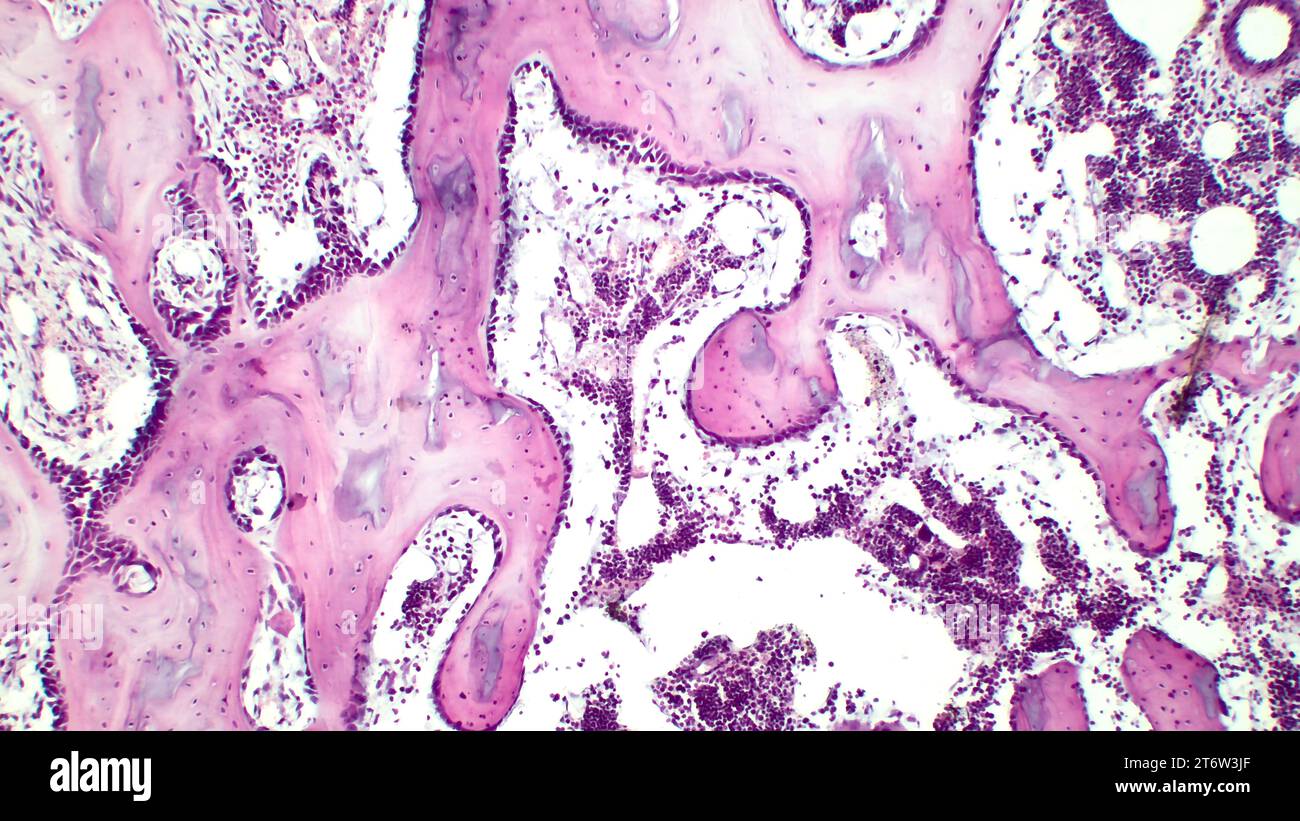 Human red bone marrow, hematopoietic press. The big tsit beetveen erythrocytes are megakaryocytes. Hematoxylin and eosin stain. Stock Photo
