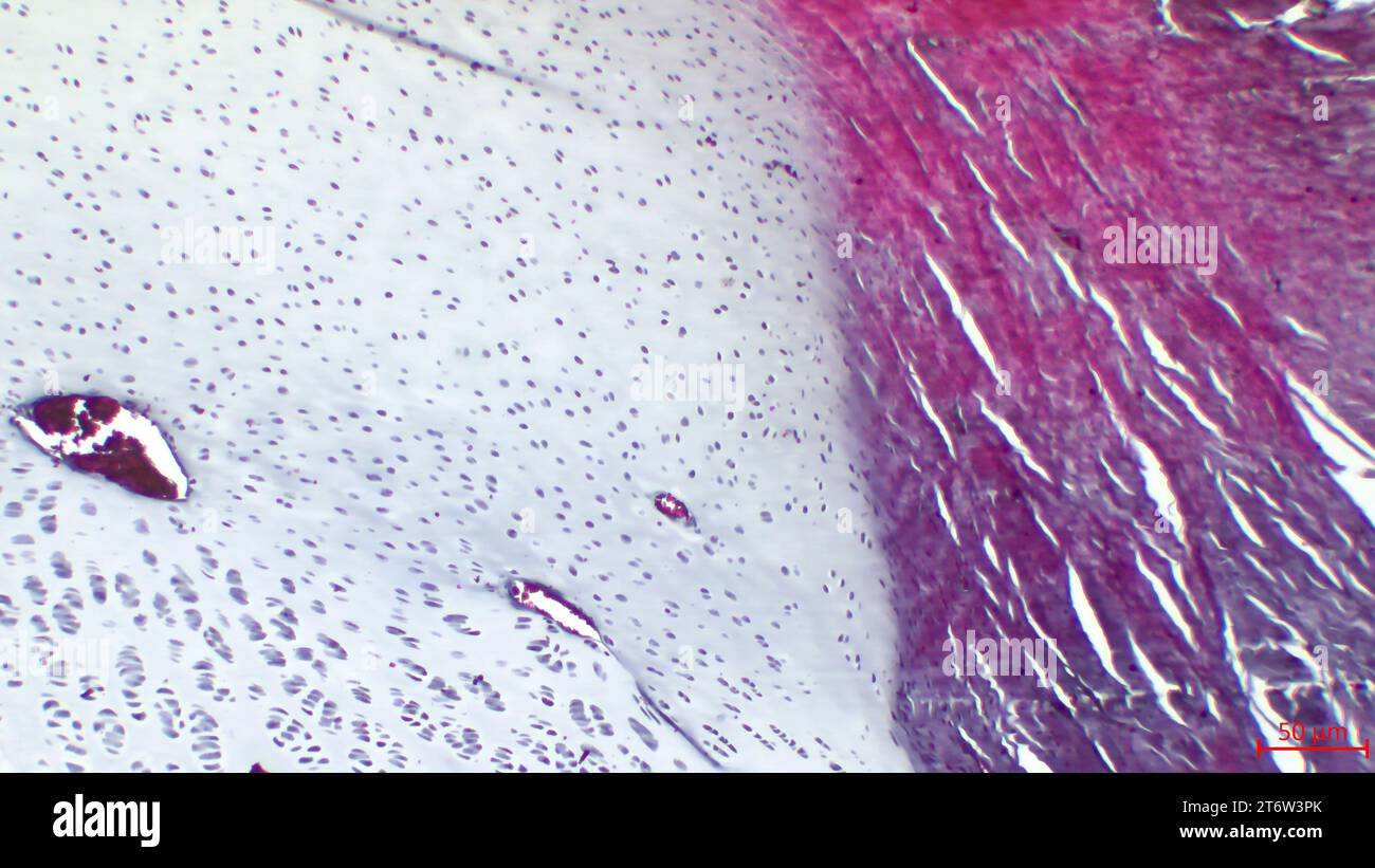 Histological structure of hyaline cartilage. Stock Photo