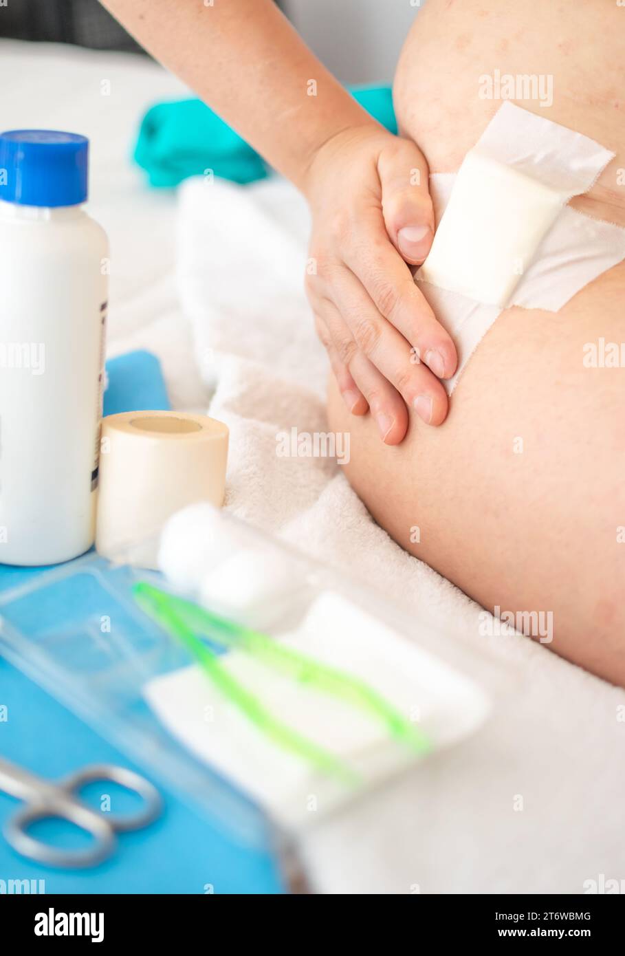 Close up view of hand touching wound with gauze on hip and Aid Kit utensils Stock Photo