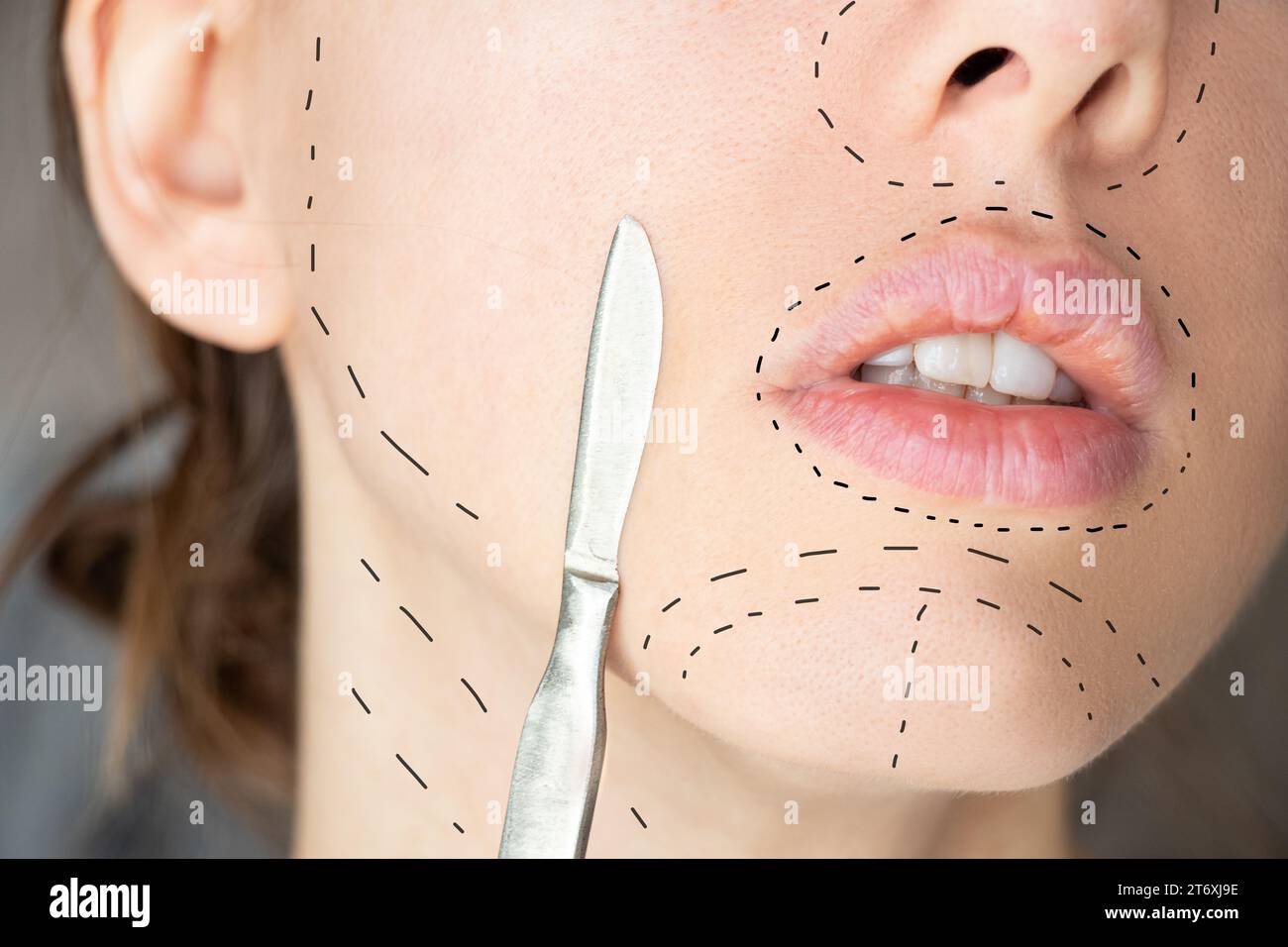 A surgical scalpel near the girl's face and dotted lines are drawn on