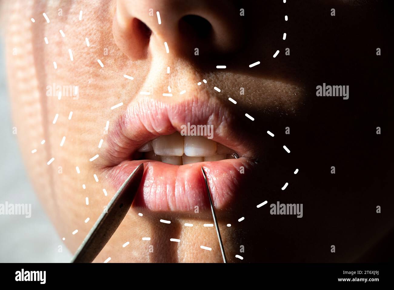 A surgical scalpel near the girl's face and dotted lines are drawn on