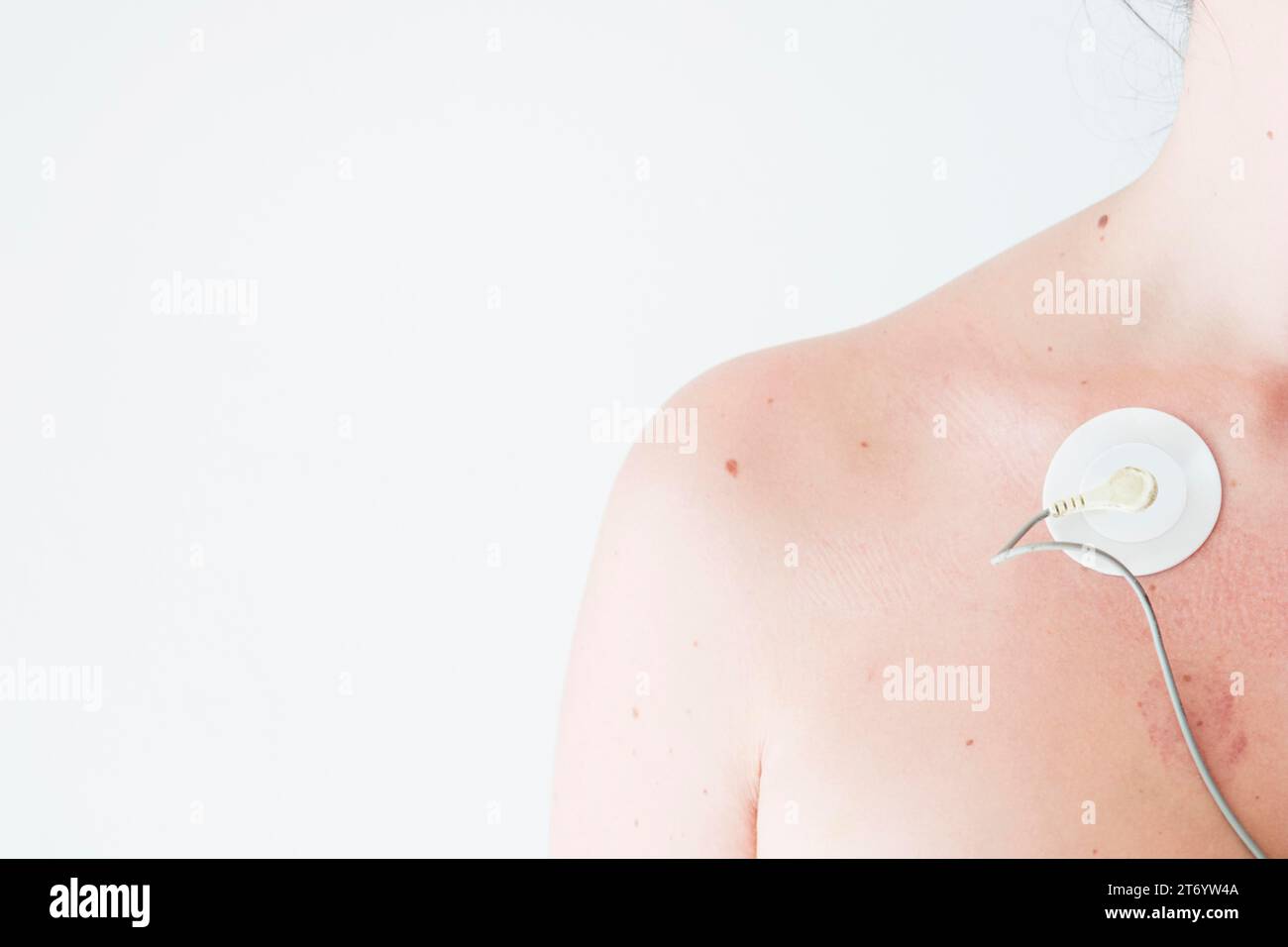 Person with electrode collarbone Stock Photo