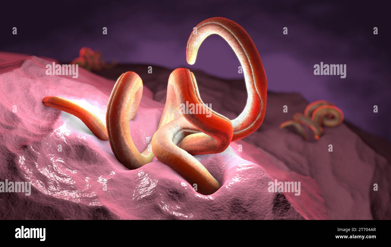 Single twisted nematode inside intestine on a black background - 3d illustration Stock Photo
