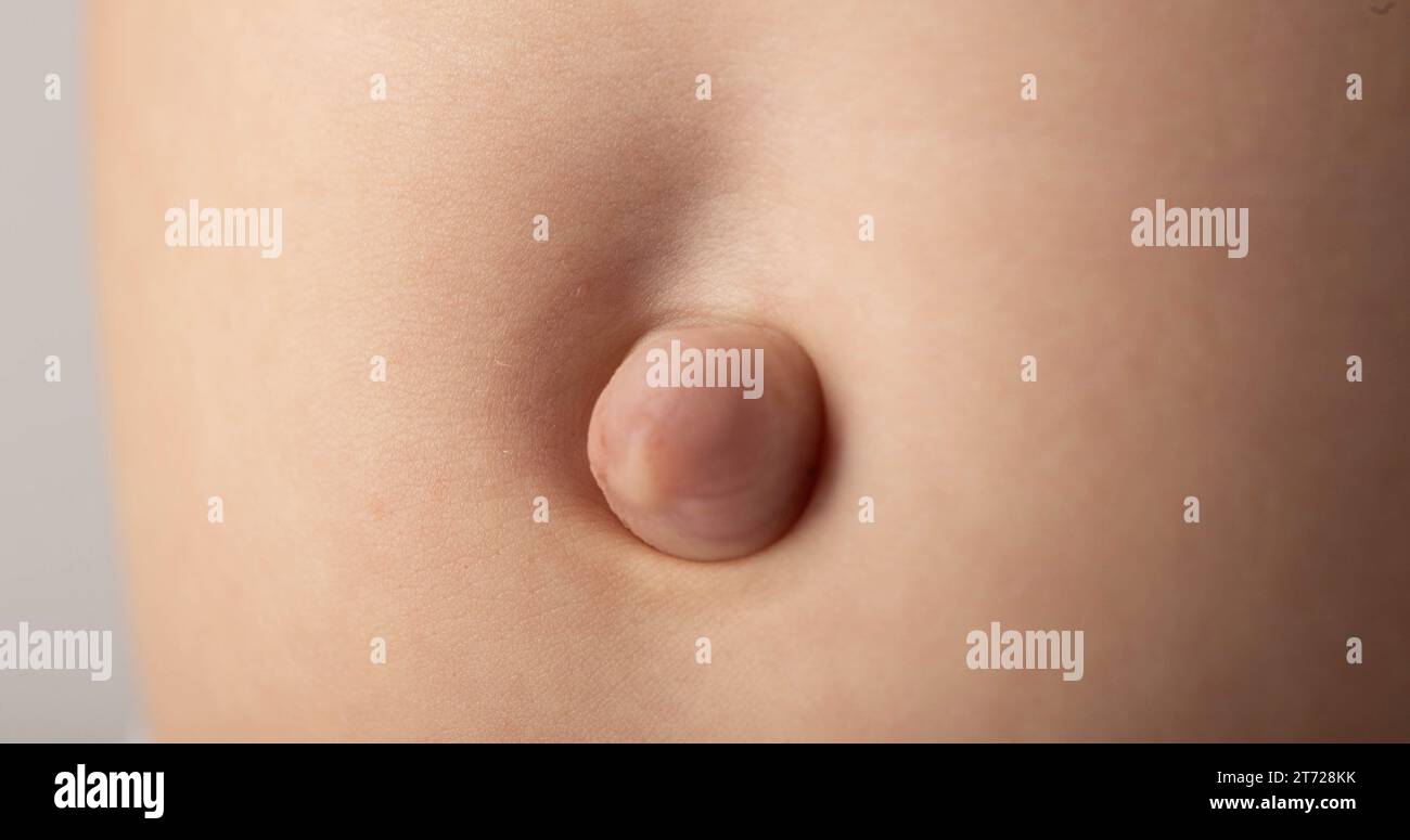 Umbilical hi-res stock photography and images - Alamy