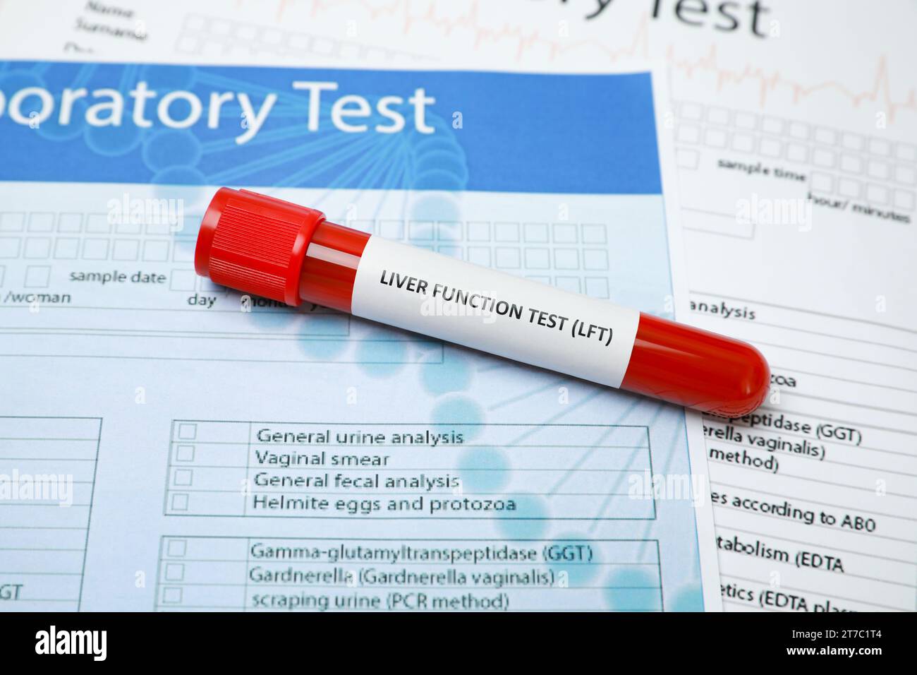 Liver Function Test. Tube with blood sample on forms, closeup Stock