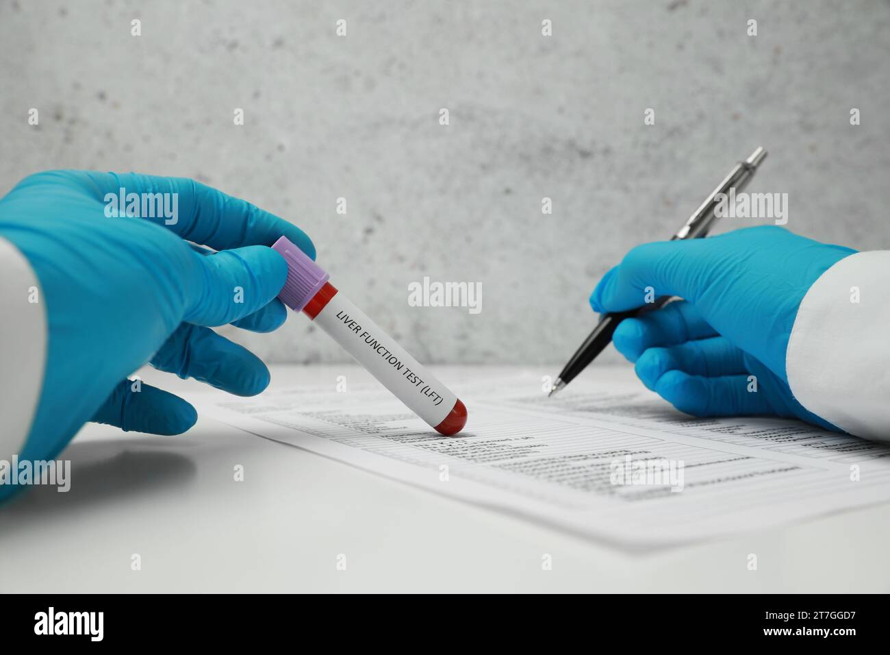 Liver Function Test. Laboratory worker holding tube with blood sample