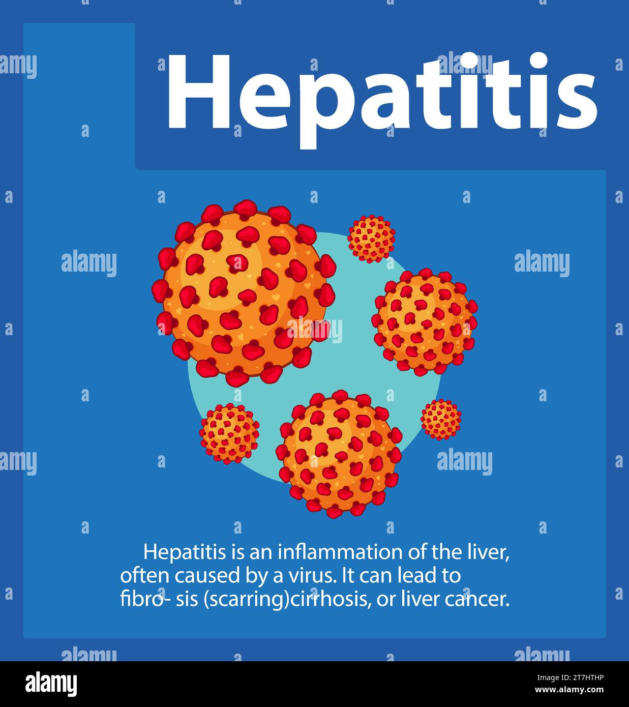 Detailed cartoon-style illustration depicting a hepatitis virus cell ...