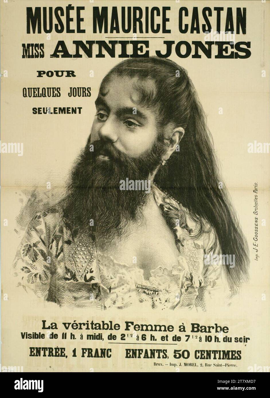 Anonym Maurice Castan Museum; Miss Annie Jones; The real beard woman. Color around 1890 Stock Photo