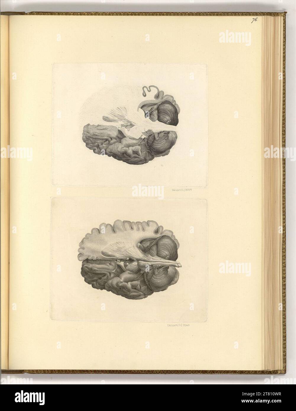 unbestimmt (An der Entstehung Beteiligte r) Anatomical representation (brain). etching 19. Century , 19th century Stock Photo