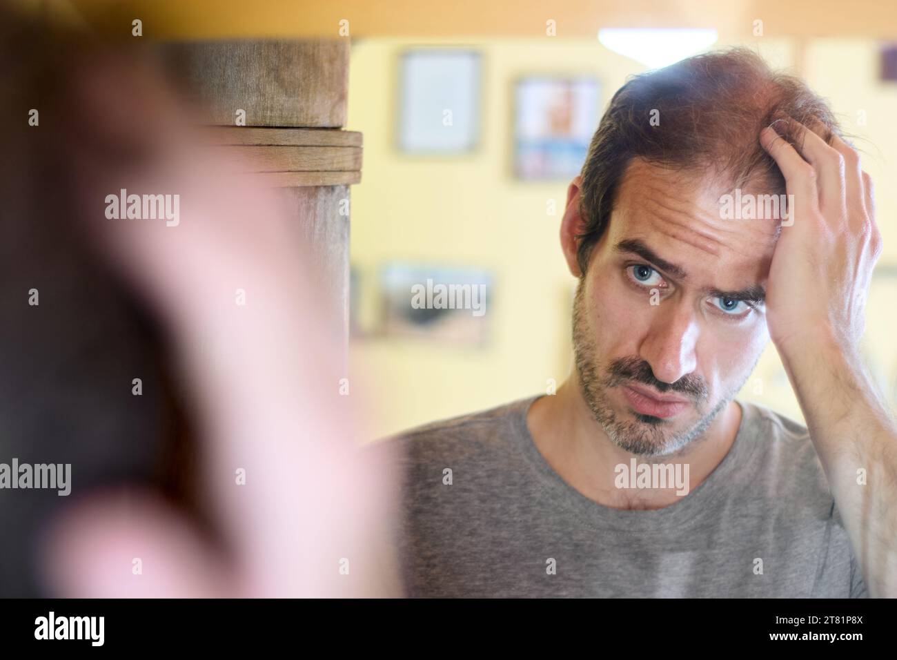 Young 30 year old caucasian man with short beard looking at his reflection in the mirror while touching his head, worried about hair loss. Copy space Stock Photo