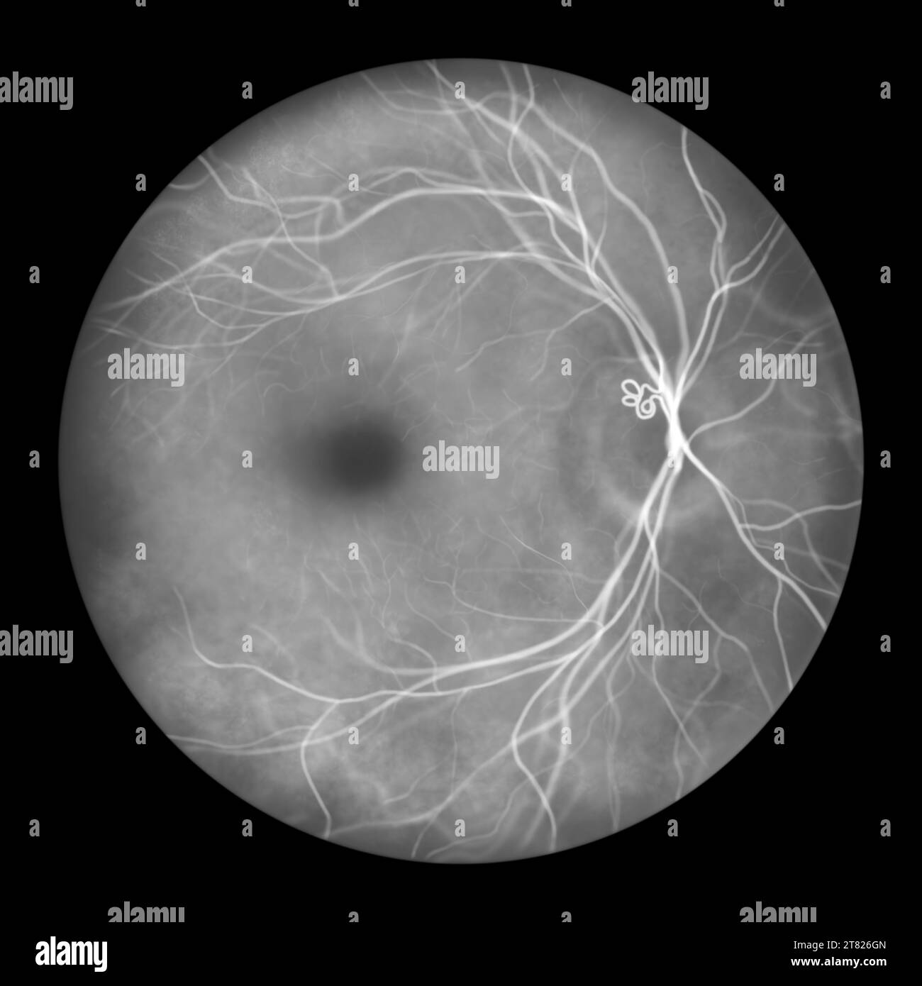 Prepapillary vascular loop on the retina, illustration Stock Photo