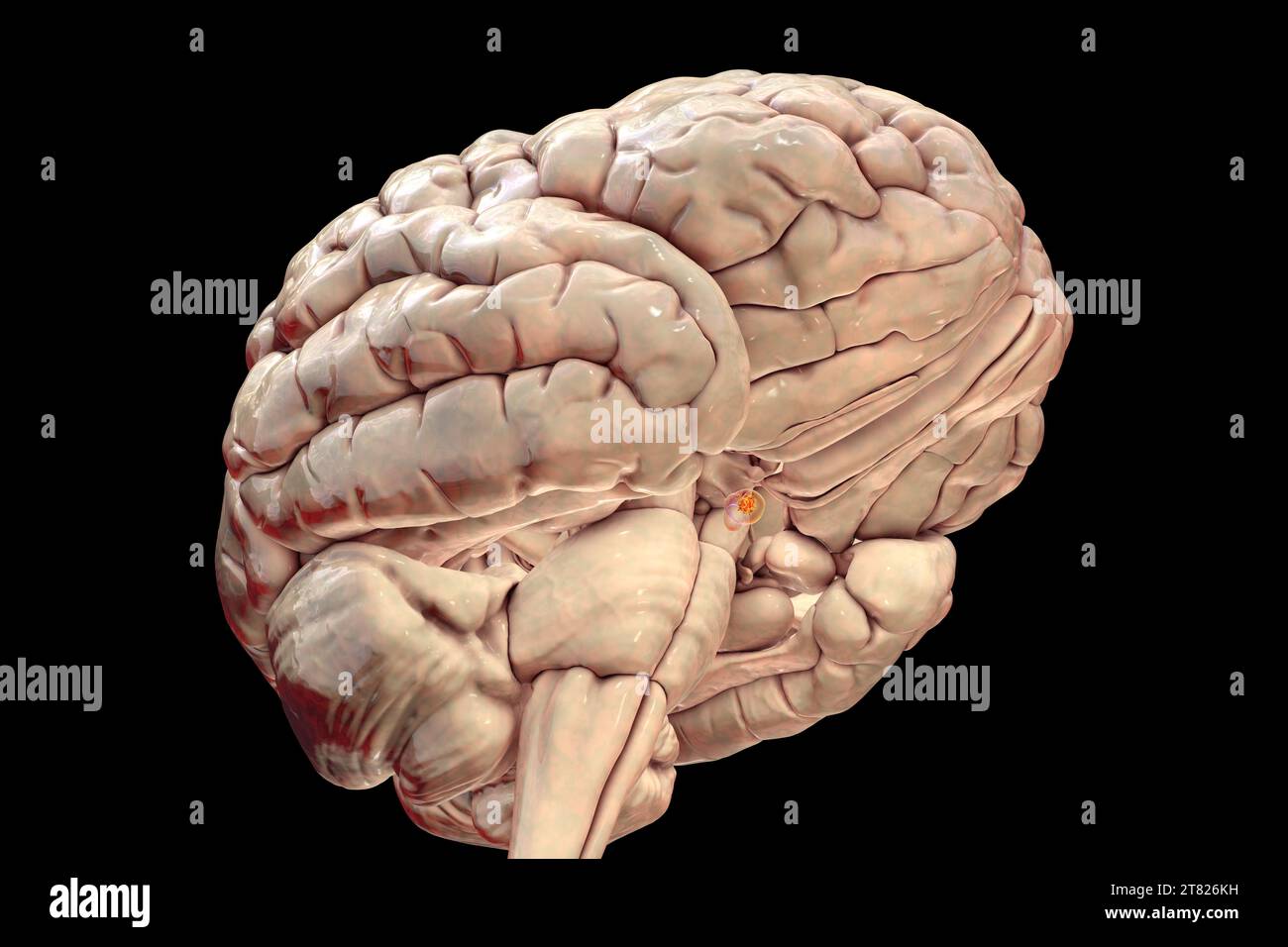Pituitary gland tumour, illustration Stock Photo