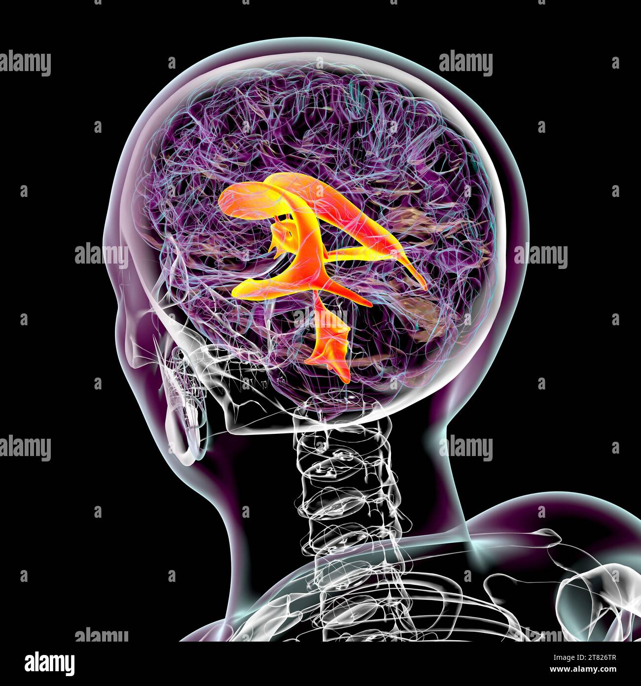 Ventricular system of the brain, computer illustration. The ventricles
