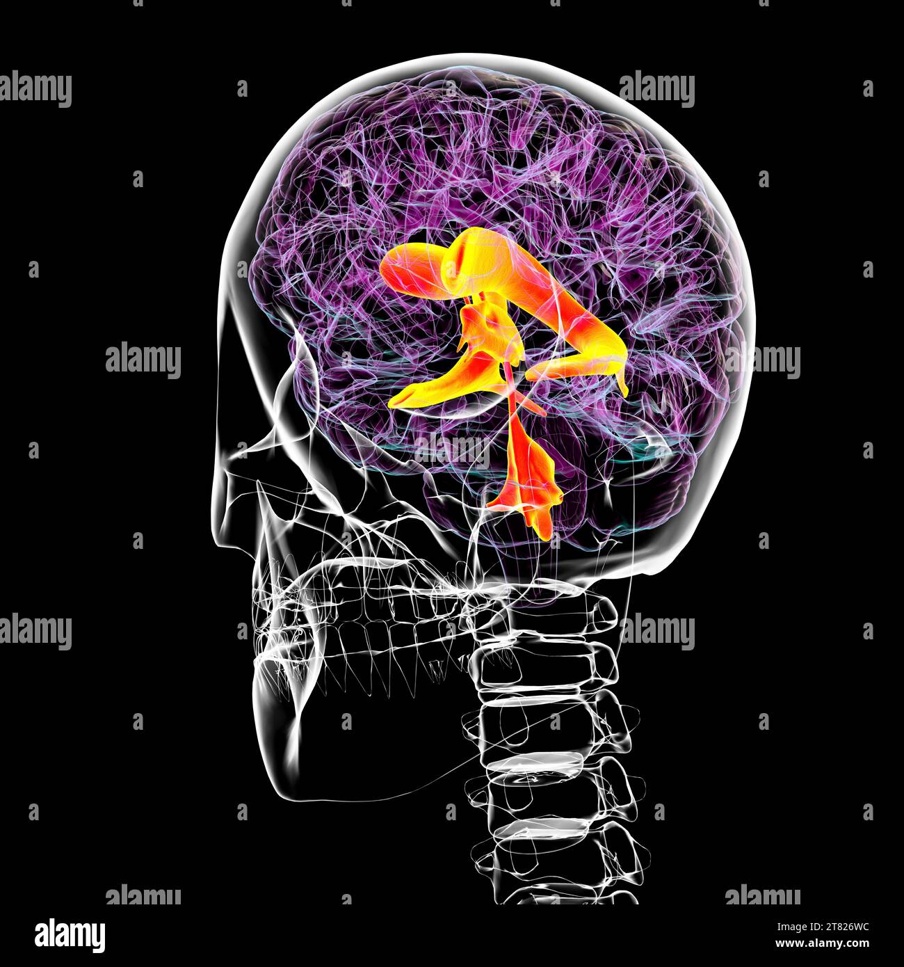 Ventricular system of the brain, illustration Stock Photo