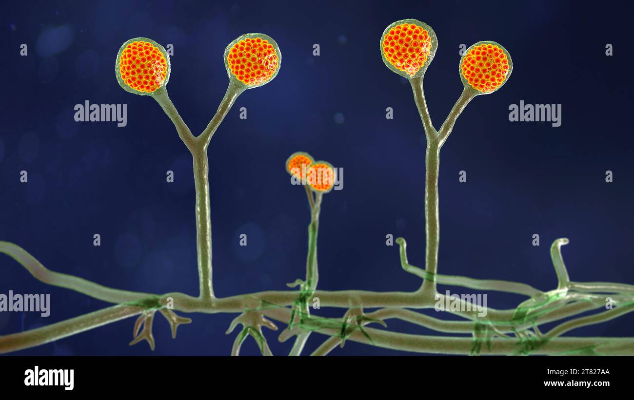Rhizomucor fungi, illustration Stock Photo