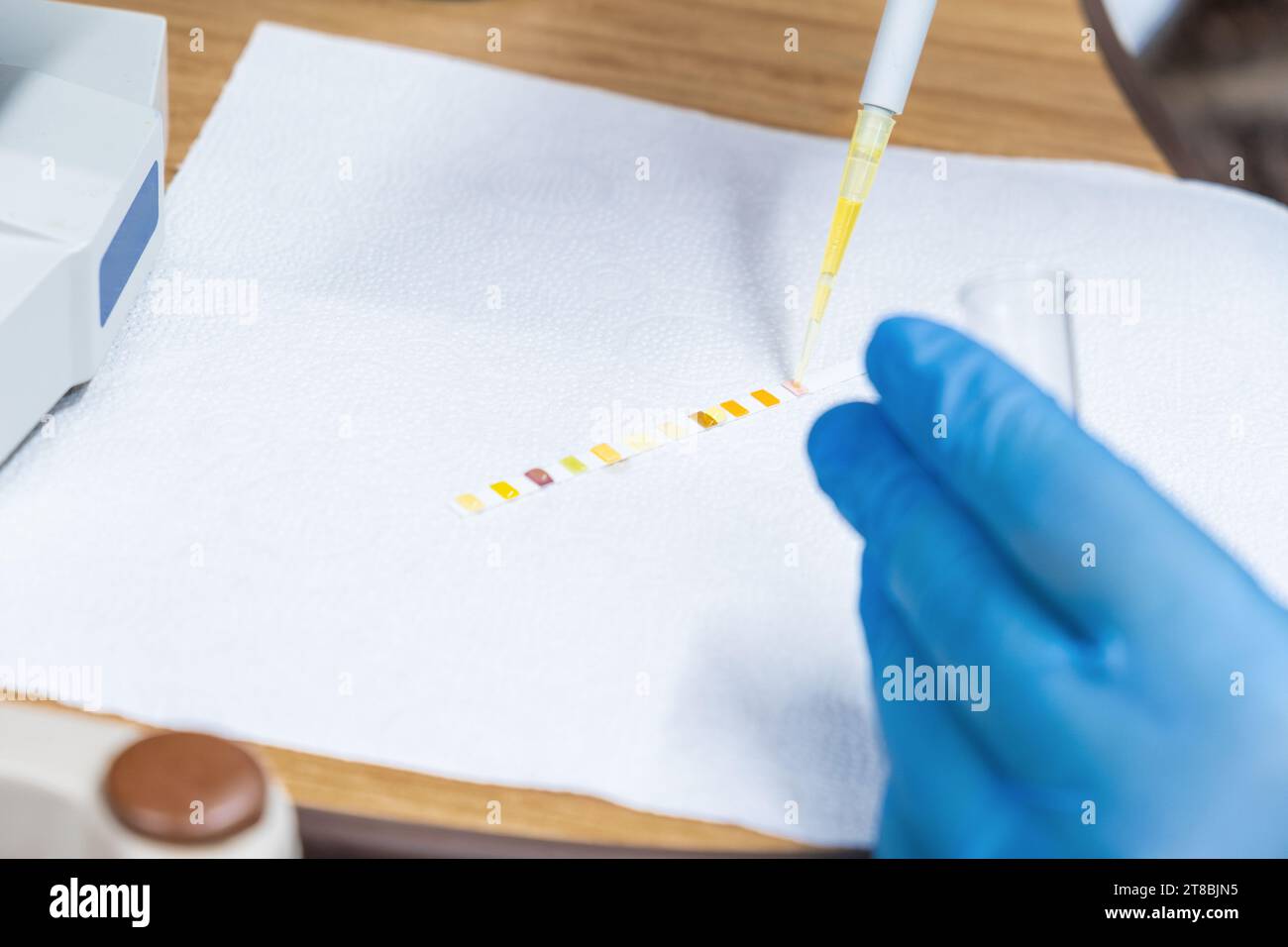 Doctor dripping urine from a pipette onto reagent strip for urinalysis