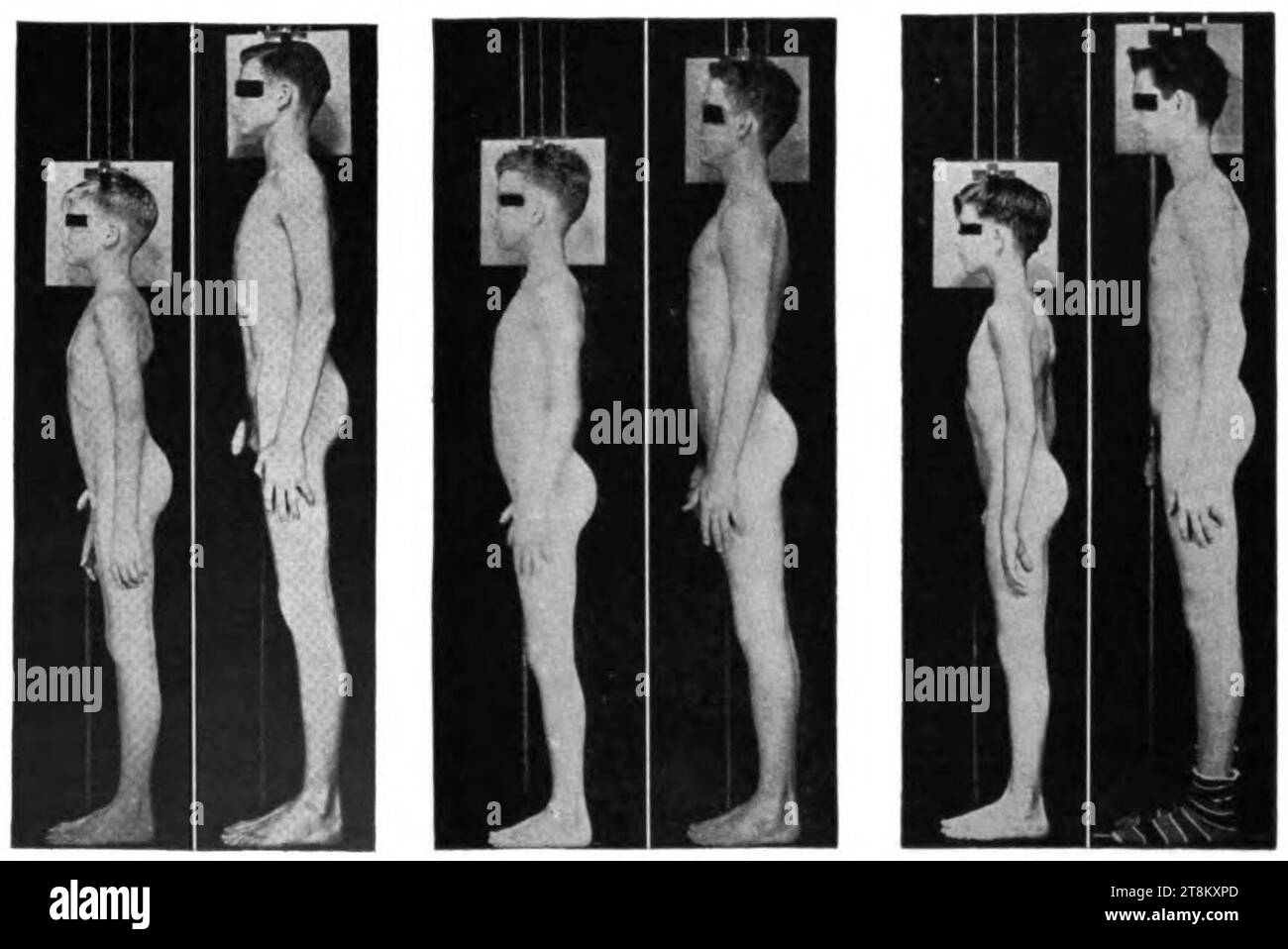boy 12 yo Variations of the height of three boys from 12yo to the end of their growth  spurt Stock Photo - Alamy