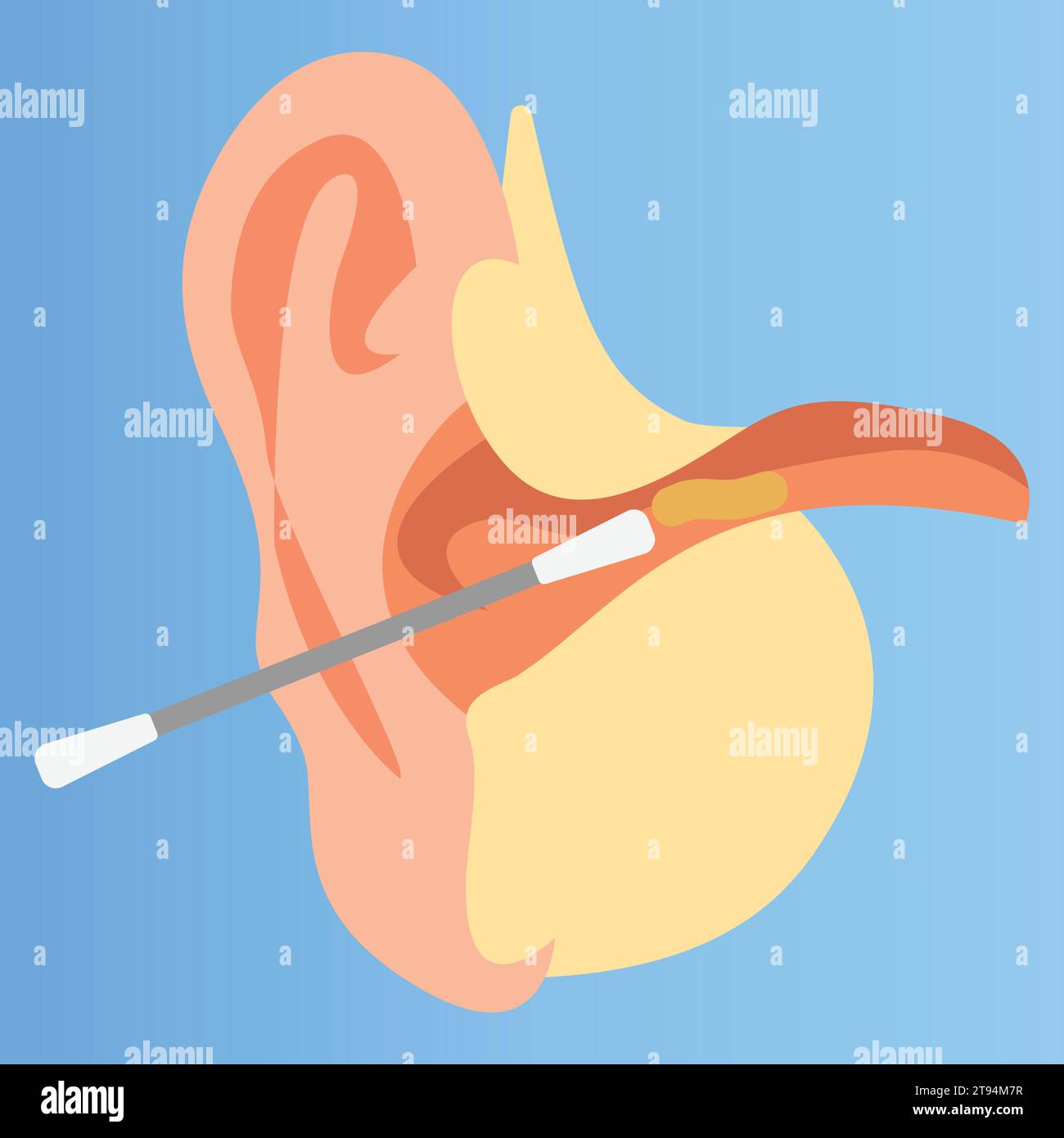 Cleaning a human ear with a cotton swab Stock Vector