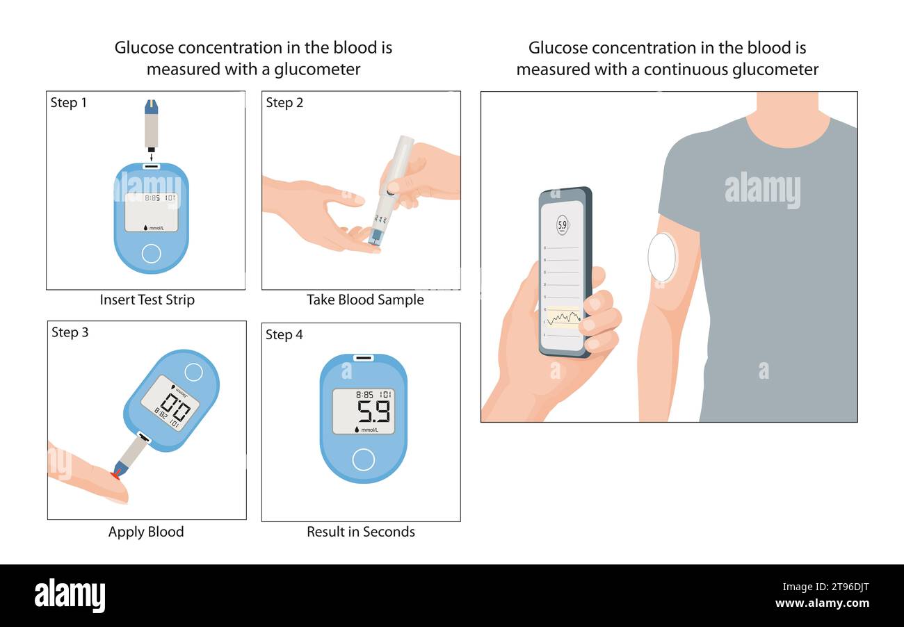 Glucometer for Blood Sugar Monitoring Stock Photo