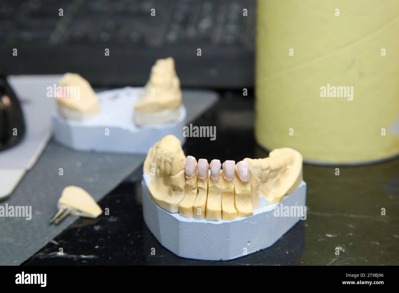 Fabrication of dental crowns and dentures made of ceramic. Scanning of plaster casts of teeth. Fabrication of ceramic dentures in a dental clinic. Cer Stock Photo