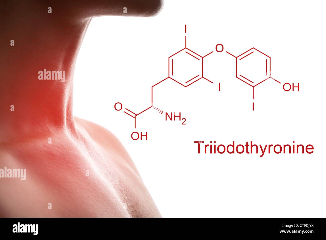 Female neck and triiodothyronine hormone formula produced by thyroid Stock Photo