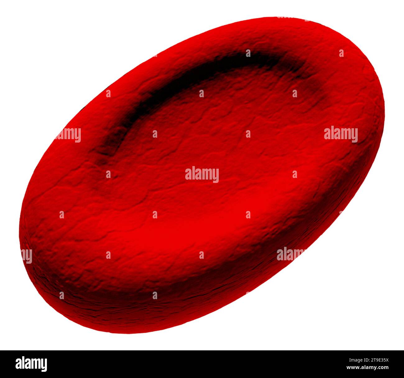 Illustration of an abnormal red blood cell (erythrocyte) known as an