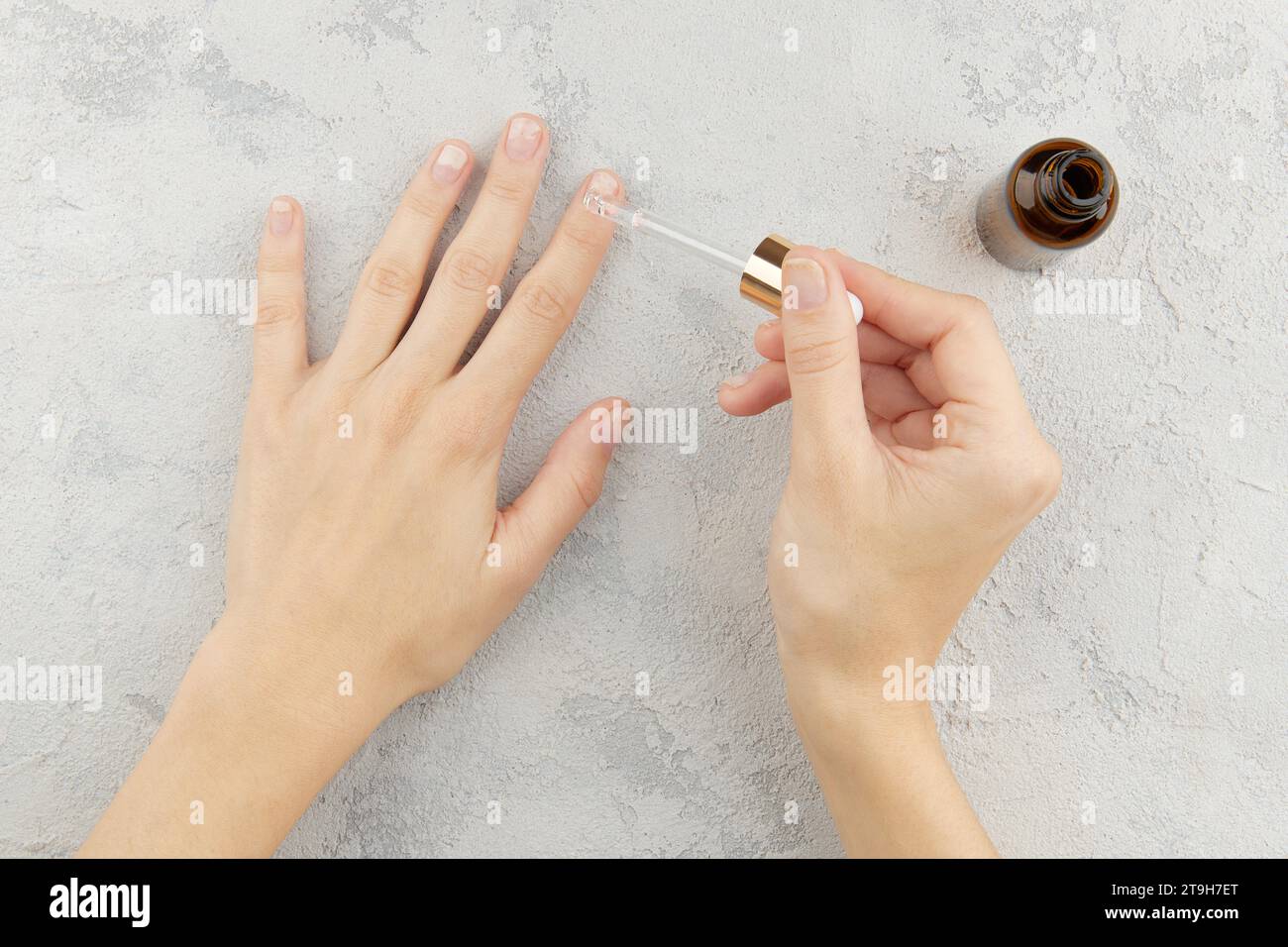Woman applying medicine to damaged nails. Fingernails with onycholysis after removing gel polish Stock Photo