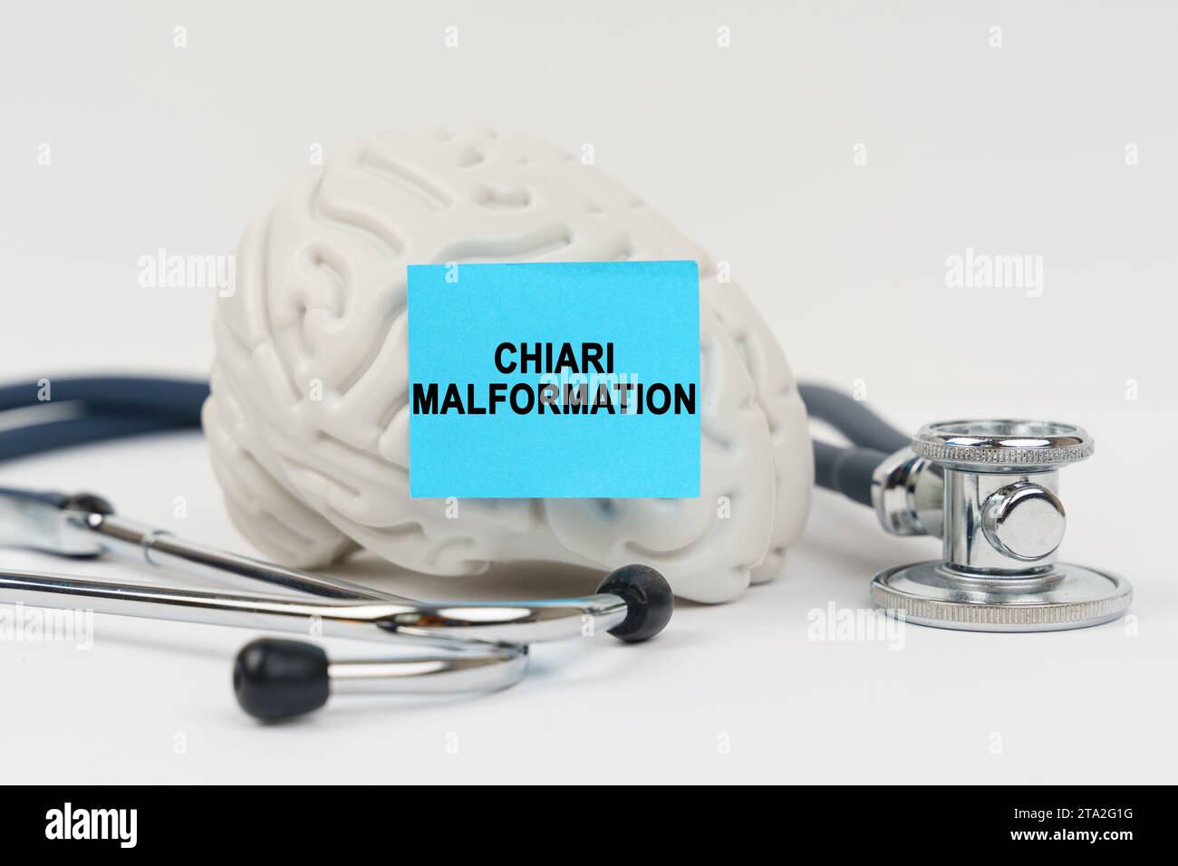 Chiari malformation hi-res stock photography and images - Alamy