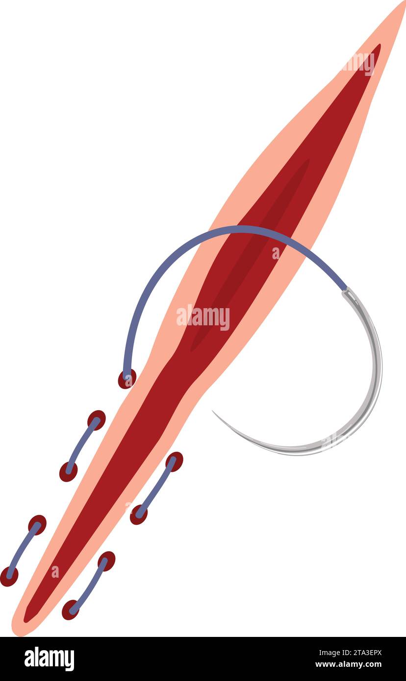 Suture tool cut icon cartoon vector. Medical body care Stock Vector ...