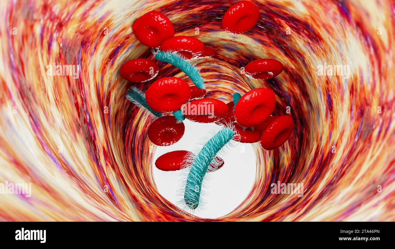 Blood flow, vein and red blood cells and sepsis. It is a potentially life-threatening condition caused by the body's response to an infection Stock Photo