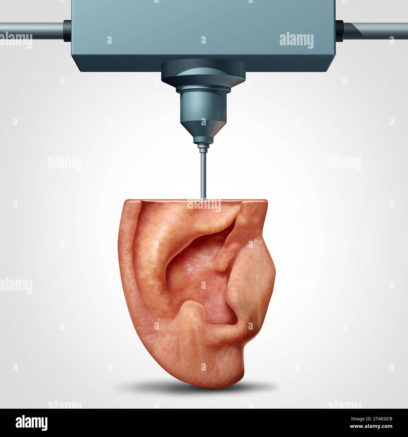 3d Bioprinting As Regenerative Medicine And Reconstructive Rhinoplasty 3d Bioprinting As Regenerative Medicine And Reconstructive Rhinoplasty