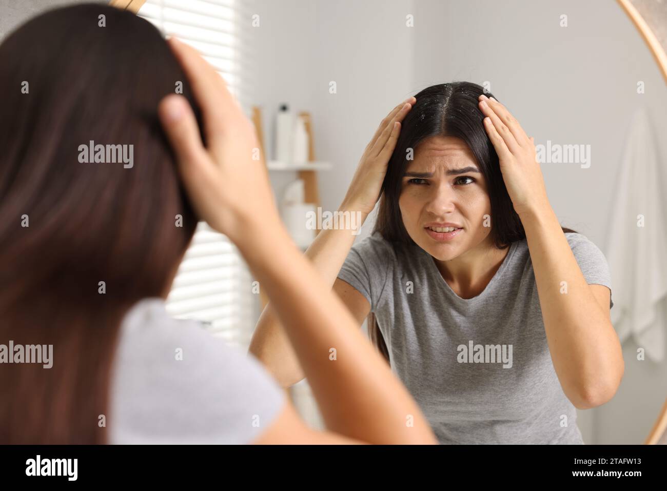 Emotional woman examining her hair and scalp near mirror in bathroom. Dandruff problem Stock Photo