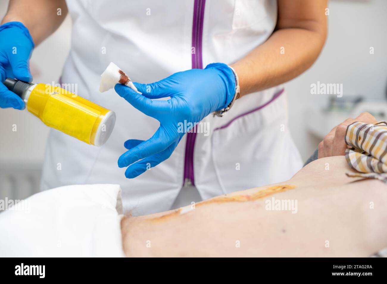 hand of Doctor is using clean cotton dressing infection wound at a man