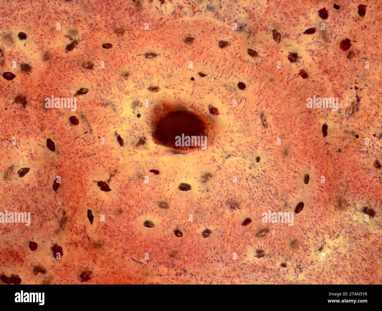 Human compact bone tissue, light micrograph Stock Photo