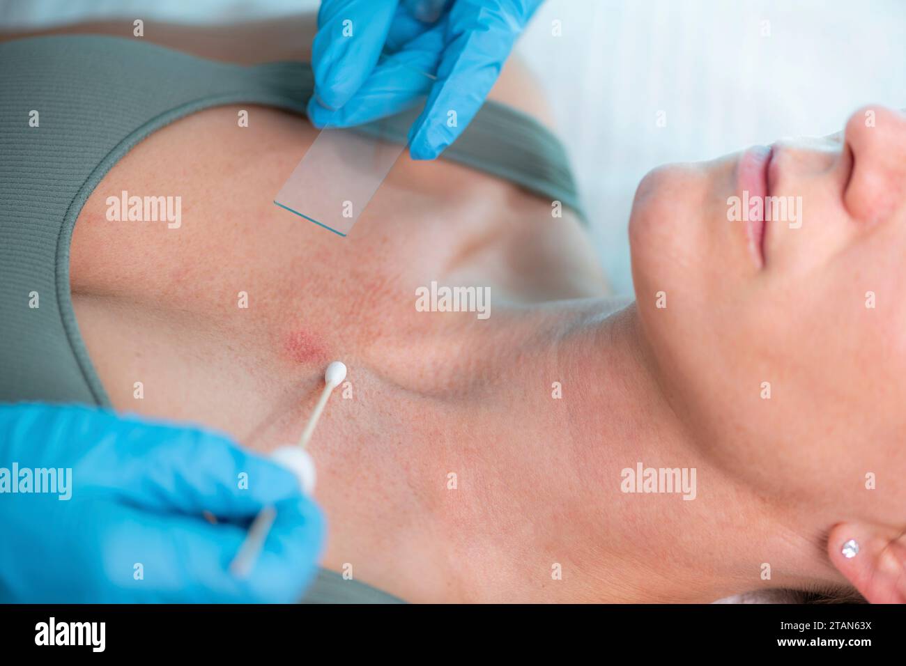 Cutaneous Sample Skin sample hi-res stock photography and images - Alamy