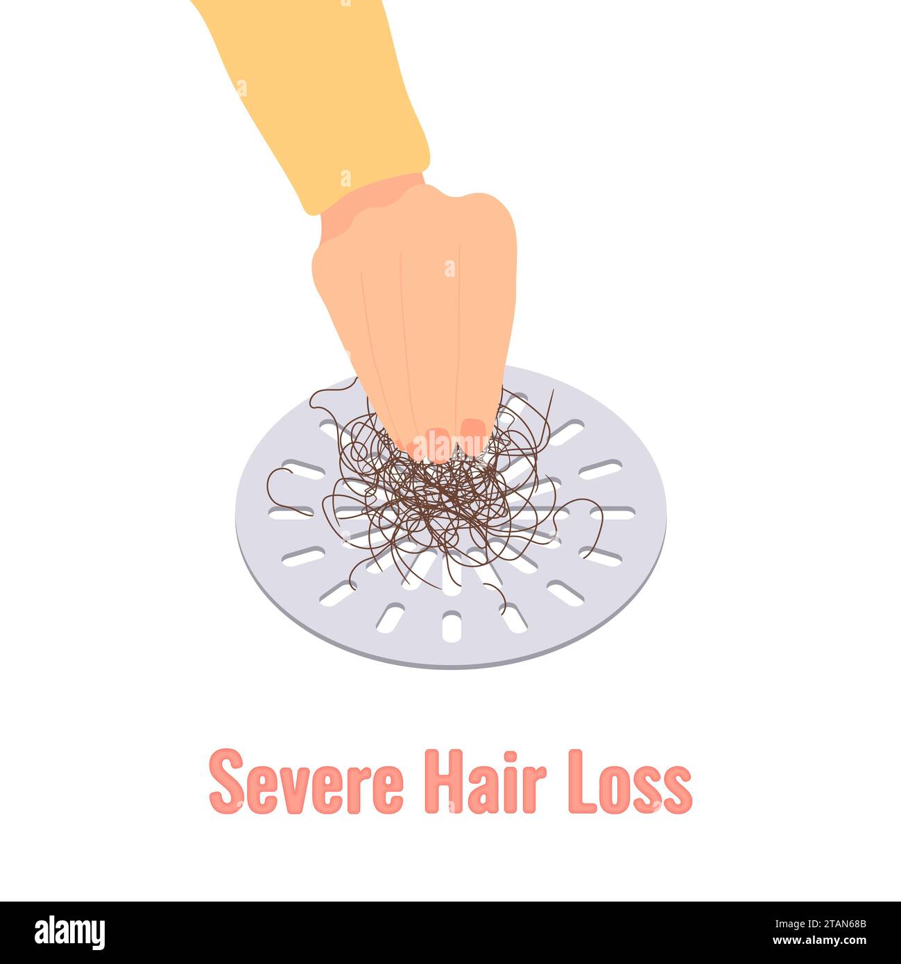Severe hair loss, conceptual illustration Stock Photo
